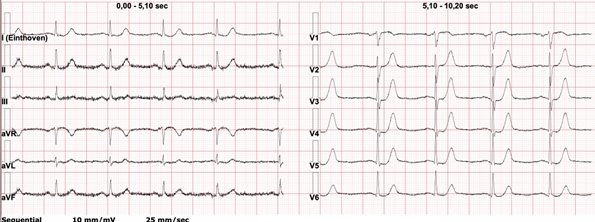 ecg-092024-2.jpg (58 KB)